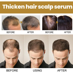 Tight Hair Shampoo Hair Cleansing Massage Scalp To Prevent Loose Tight Hair Roots Strong And Solid Hair Shampoo