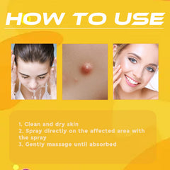 Bee Venom Wart Treatment Spray Improves Pimples, Moles, Repairs and Smooths Skin Wart Treatment Spray
