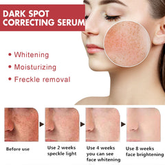 Dark Spots Repair Essence, Moisturizing And Brightening Repair Essence For Dark Spots And Age Spots